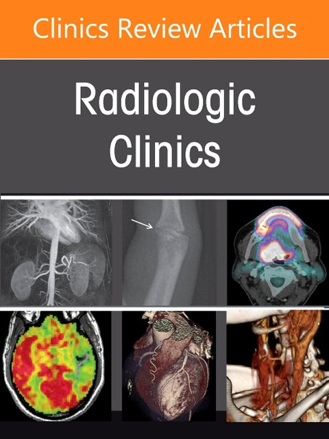 Practical Positron Emission Tomography for Radiologists, an Issue of Radiologic Clinics of North America: Volume 64-6 by Siegel, Eliot
