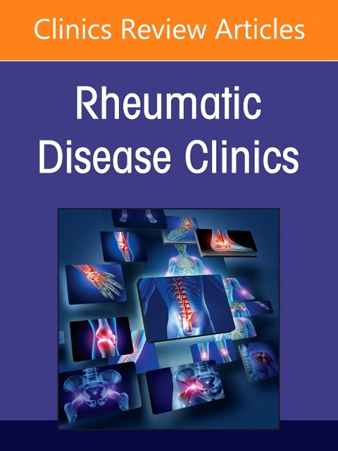 Ent Manifestations in Rheumatology, an Issue of Rheumatic Disease Clinics of North America: Volume 52-4 by Kaplan, Seth E.