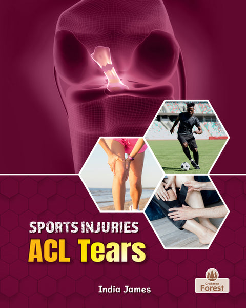 ACL Tears by James, India