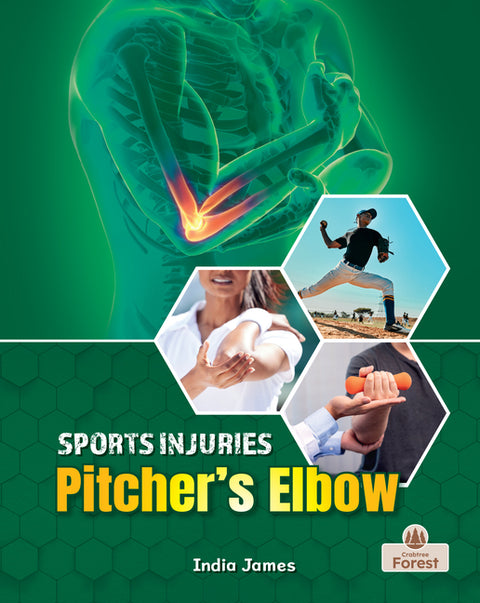 Pitcher's Elbow by James, India