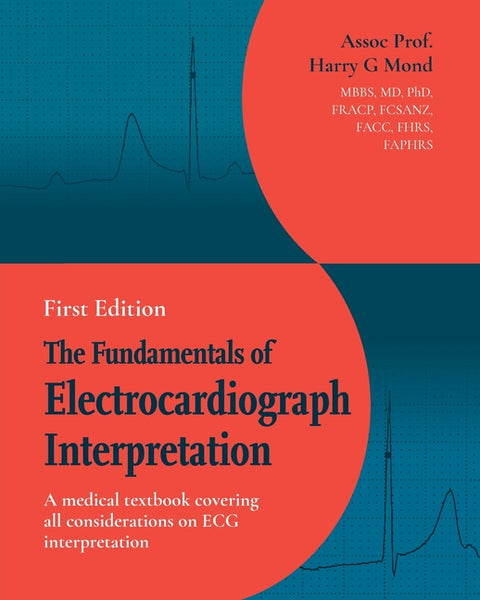 The Fundamentals of Electrocardiograph Interpretation: A medical textbook covering all considerations on ECG interpretation