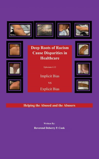 Deep Roots of Racism Cause Disparities in Healthcare: Implicit Bias vs Explicit Bias: Helping Both the Abused and the Abusers