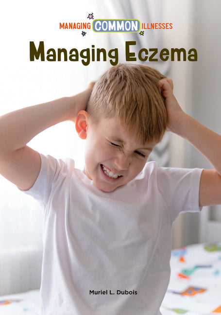Managing Eczema by DuBois, Muriel