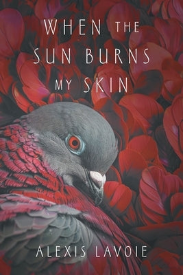 When the Sun Burns My Skin by Lavoie, Alexis