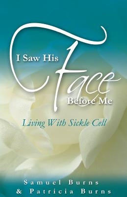 I Saw His Face Before Me - Living with Sickle Cell Anemia by Burns, Samuel a.