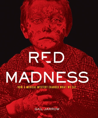 Red Madness: How a Medical Mystery Changed What We Eat by Jarrow, Gail