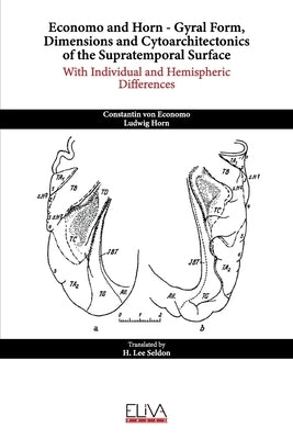Economo and Horn - Gyral Form, Dimensions and Cytoarchitectonics of the Supratemporal Surface by Lee Seldon, H.