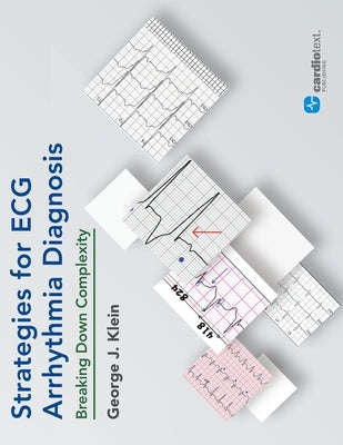 Strategies for ECG Arrhythmia Diagnosis: Breaking Down Comlexity: Breaking Down Complexity by Klein, George J.