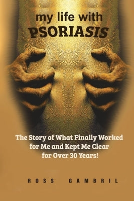 my life with PSORIASIS: The story of what finally worked for me and kept me clear for over 30 years! by Gambril, Ross