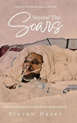 Beyond The Scars: A Journey of Resilience, Hope, and Power by Hayes, Steven