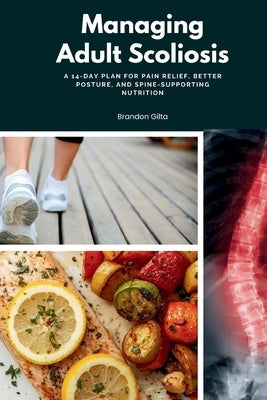 Managing Adult Scoliosis: A 14-Day Plan for Pain Relief, Better Posture, and Spine-Supporting Nutrition by Jeffrey Winzant, Jeffrey