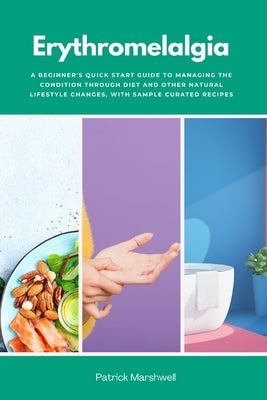 Erythromelalgia: A Beginner's Quick Start Guide to Managing the Condition Through Diet and Other Natural Lifestyle Changes, With Sample Curated Recipe by Marshwell, Patrick