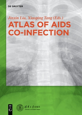 Atlas of AIDS Co-Infection by Jinxin, Liu