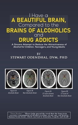 I Have a Beautiful Brain, Compared to the Brains of Alcoholics and Drug Addicts by Odendhal, DVM