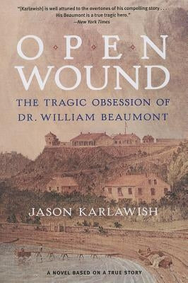 Open Wound: The Tragic Obsession of Dr. William Beaumont by Karlawish, Jason