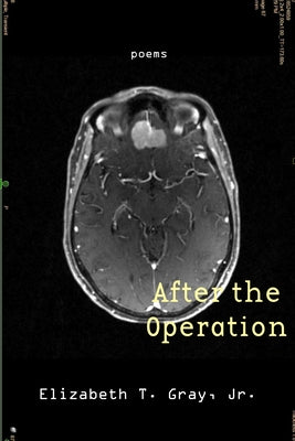 After the Operation by Gray, Elizabeth T.