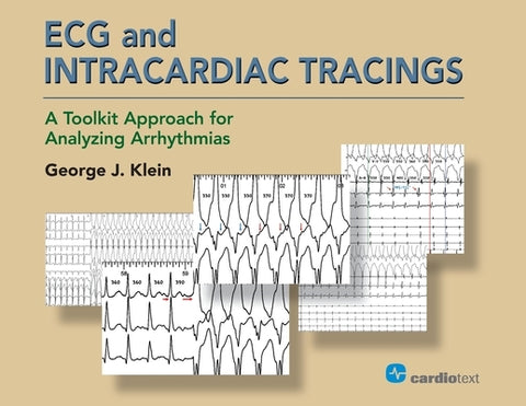 ECG and Intracardiac Tracings: A Toolkit Approach for Analyzing Arrhythmias by Klein, George J.