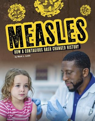 Measles: How a Contagious Rash Changed History by Lewis, Mark K.