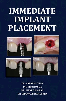 Immediate Implant Placement by Dhan, Aadarsh