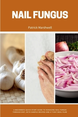 Nail Fungus: A Beginner's Quick Start Guide to Managing Nail Fungus Through Diet, With Sample Recipes and a 7-Day Meal Plan by Marshwell, Patrick