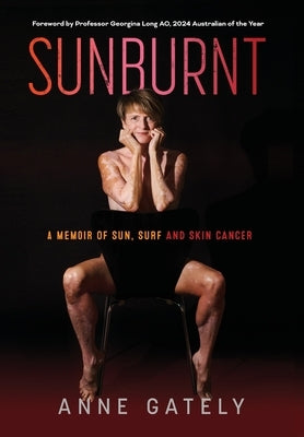 Sunburnt: A memoir of sun, surf and skin cancer by Gately, Anne C.