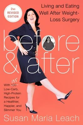 Before & After 2nd REV Ed PB by Leach, Susan Maria