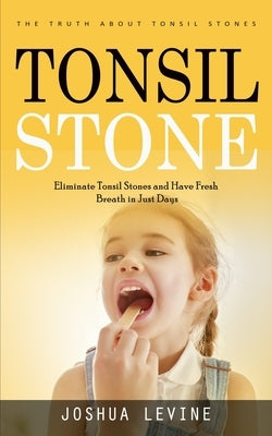 Tonsil Stones: The Truth about Tonsil Stones (Eliminate Tonsil Stones and Have Fresh Breath in Just Days!) by Levine, Joshua