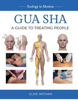 Gua sha: A Guide to Treating People by Witham, Clive