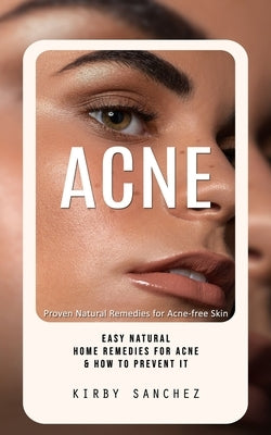 Acne: Proven Natural Remedies for Acne-free Skin (Easy Natural Home Remedies for Acne & How to Prevent It) by Sanchez, Kirby