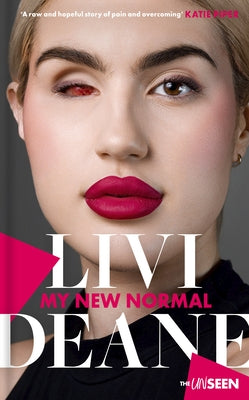 My New Normal: Learning to Celebrate What's Different about You by Deane, Livi