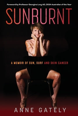 Sunburnt: A memoir of sun, surf and skin cancer by Gately, Anne C.