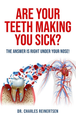 Are Your Teeth Making You Sick?: The Answer Is Right Under Your Nose by Reinertsen, Charles W.