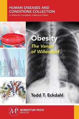 Obesity: The Venus of Willendorf by Eckdahl, Todd T.