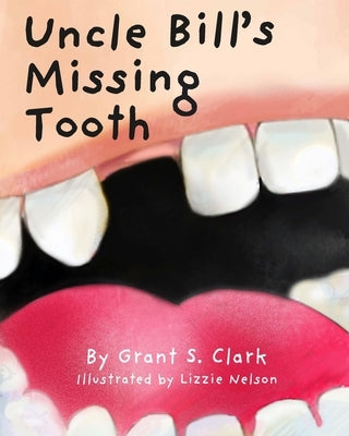 Uncle Bill's Missing Tooth by Clark, Grant