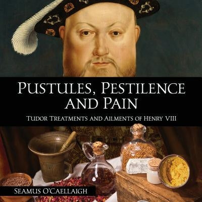 Pustules, Pestilence and Pain: Tudor Treatments and Ailments of Henry VIII by O'Caellaigh, Seamus