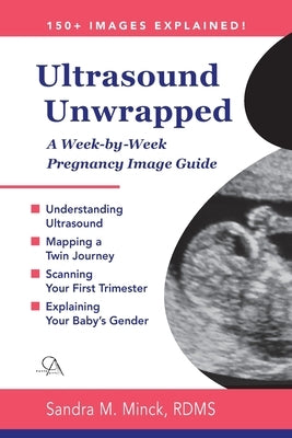 Ultrasound Unwrapped: A Week-by-Week Pregnancy Image Guide by Minck Rdms, Sandra M.