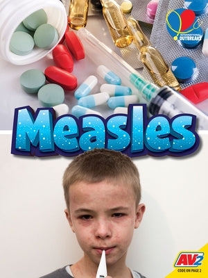 Measles by Hudak, Heather C.