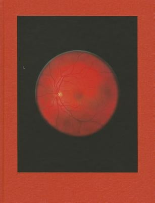 Michael Subotzky: Retinal Shift by Subotzky, Mikhael