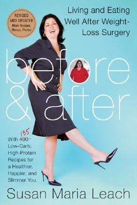 Before & After: Living and Eating Well After Weight-Loss Surgery by Leach, Susan Maria