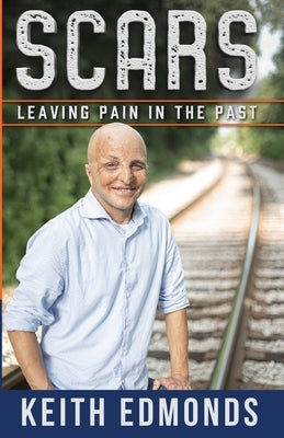 Scars Leaving Pain in the Past by Edmonds, Keith