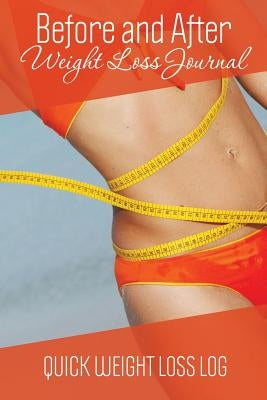Before and After Weight Loss Journal: Quick Weight Loss Log by Speedy Publishing LLC